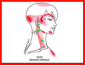 Formation aux trigger points - Alain Marzolf